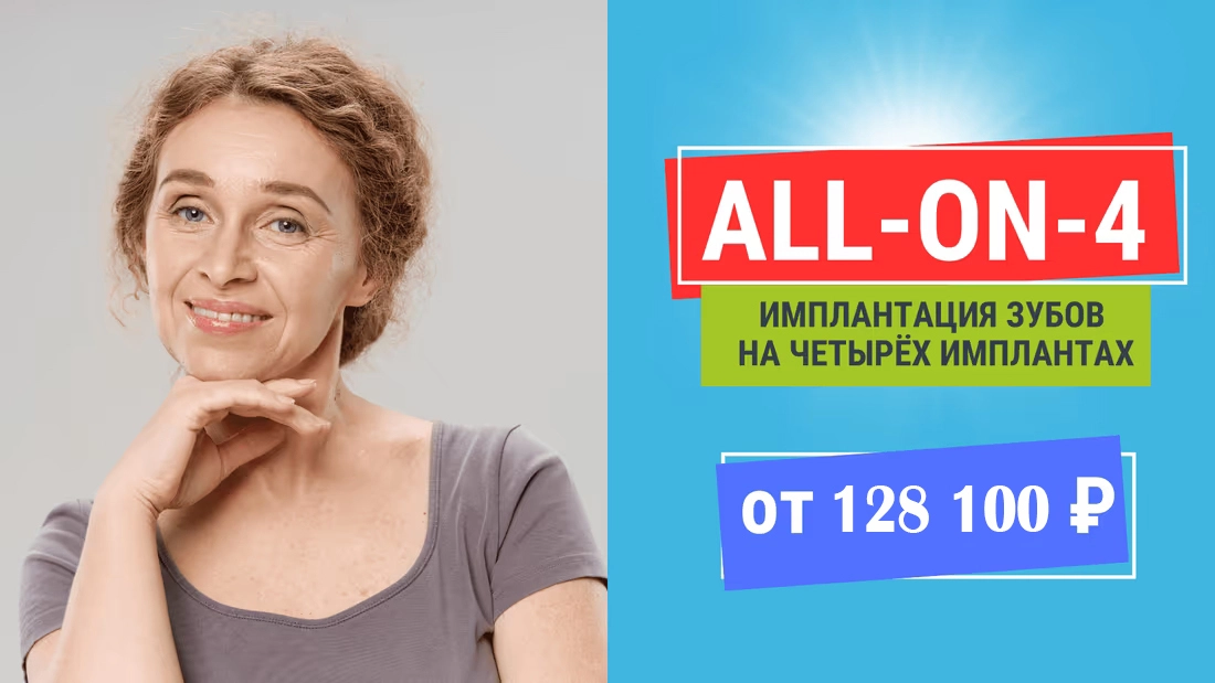 Имплантация all on 4